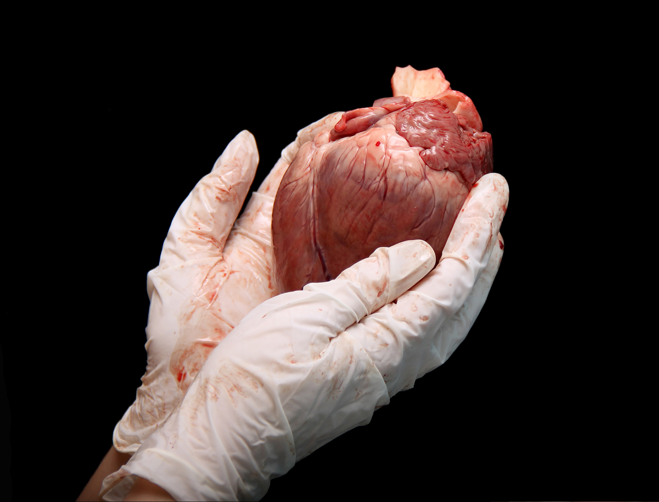 Injectable gel used as scaffolding to repair damaged heart