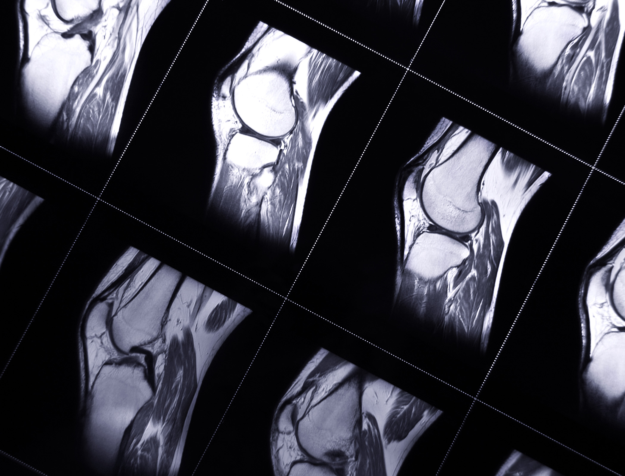 Continuous 3D deep-tissue monitoring possible with ultrasound patch