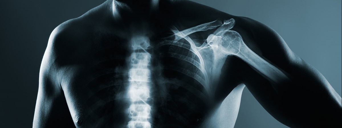 Deep learning could help visualise X-ray data in 3D