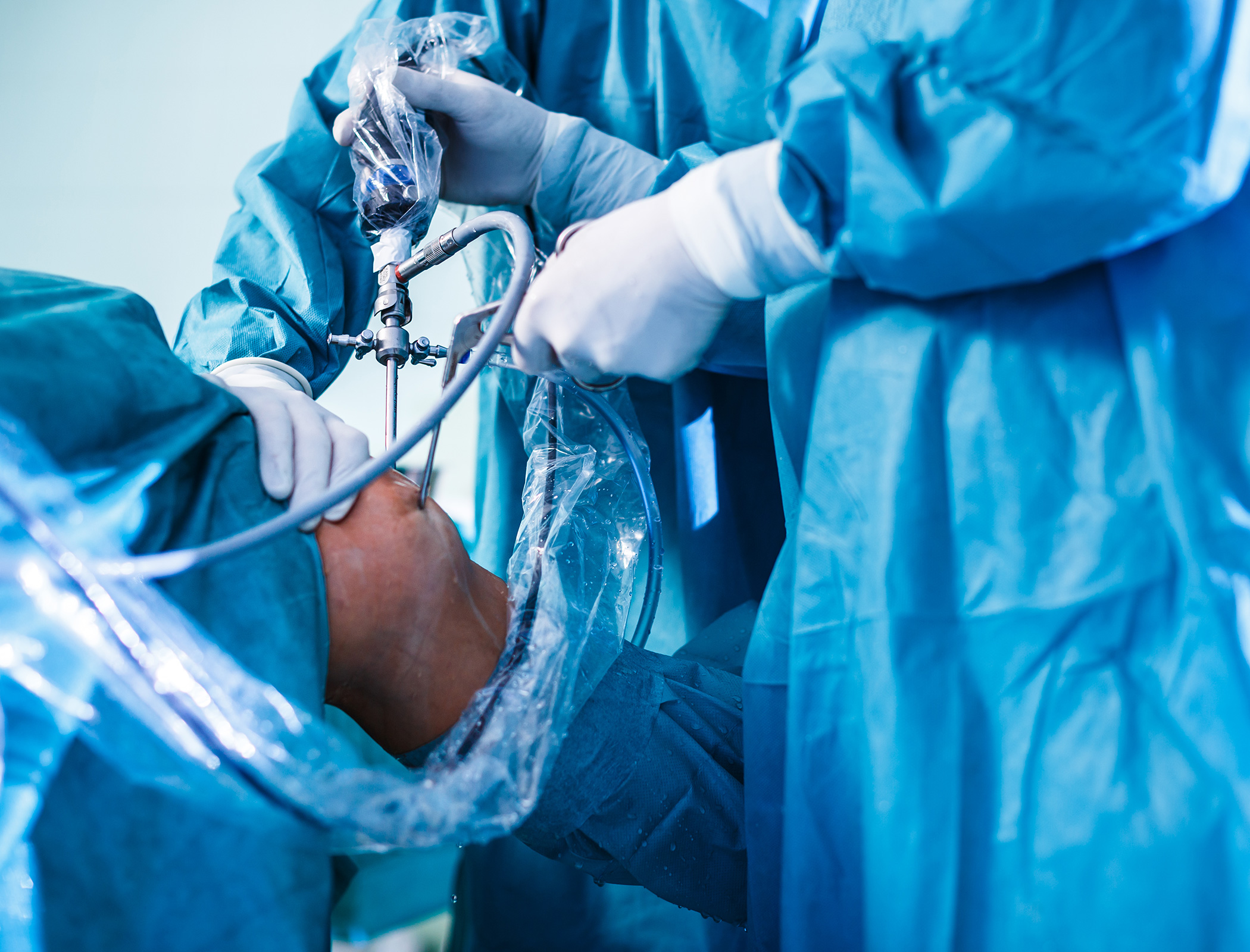 Lab-made gel that outperforms cartilage paves way for next-gen knee operations