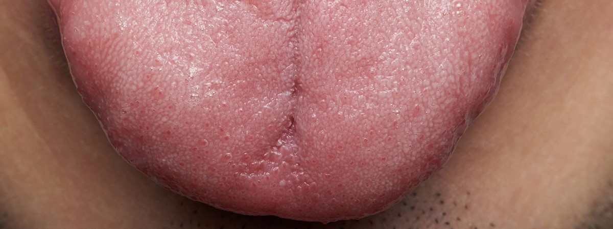3D-printed human tongue developed for food tests and dry mouth cures