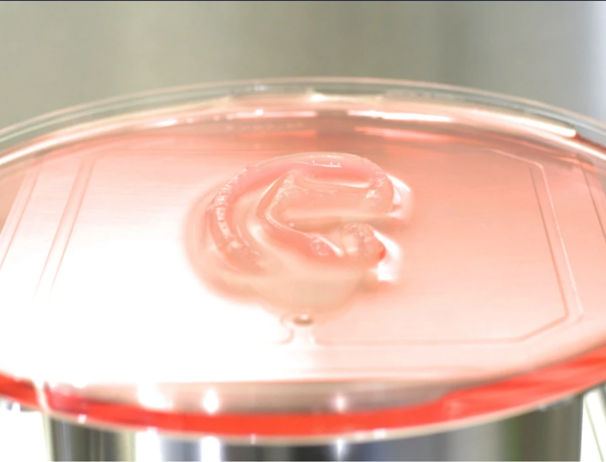 Woman receives ‘revolutionary’ transplant of 3D-printed ear