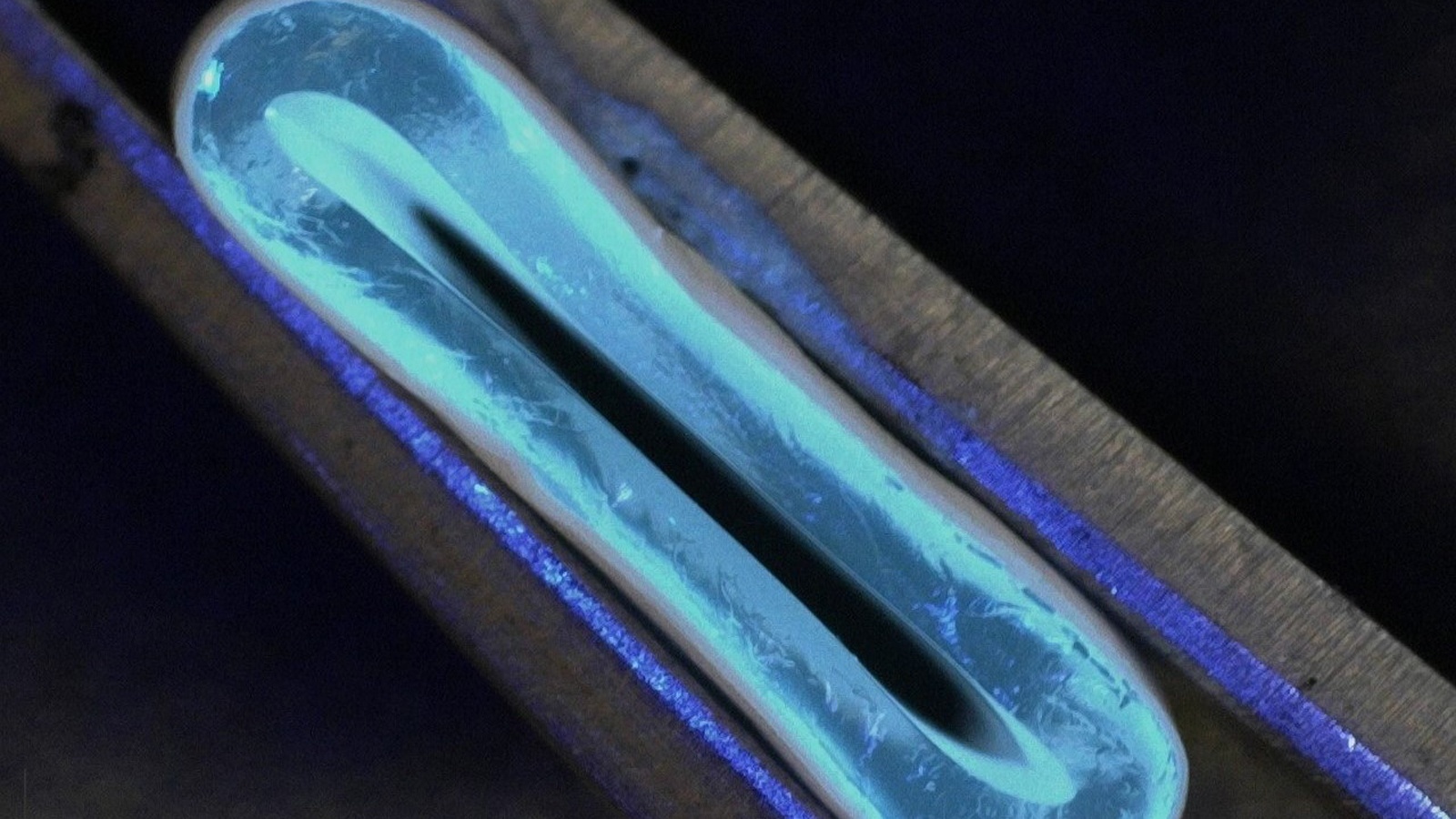 3D-printed blood vessels could improve heart bypass outcomes