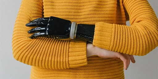woman in yellow jumper with prosthetic hand